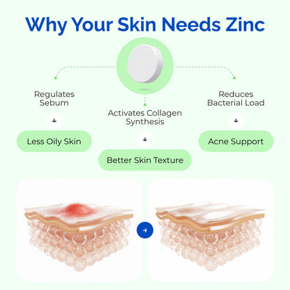 Nuzinc - Nutrifactor Immune Support - Image 5